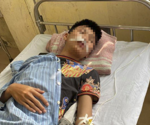 Hà Nội: Nam sinh lớp 11 bị đánh hội đồng đến rách miệng, gãy một phần răng cửa
